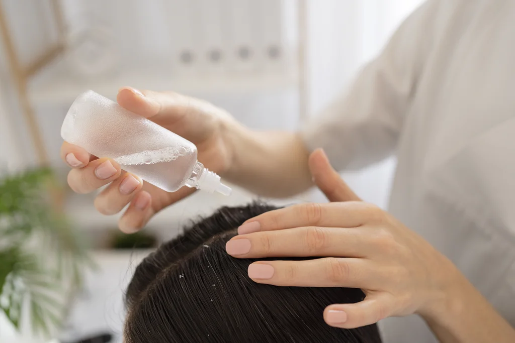 dokter mengaplikasikan toner untuk merawat rambut rontok.