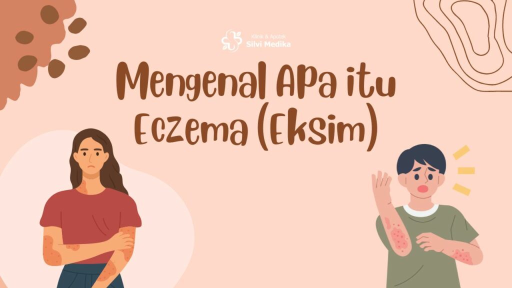 Mengenal Apa itu Eczema (Eksim)