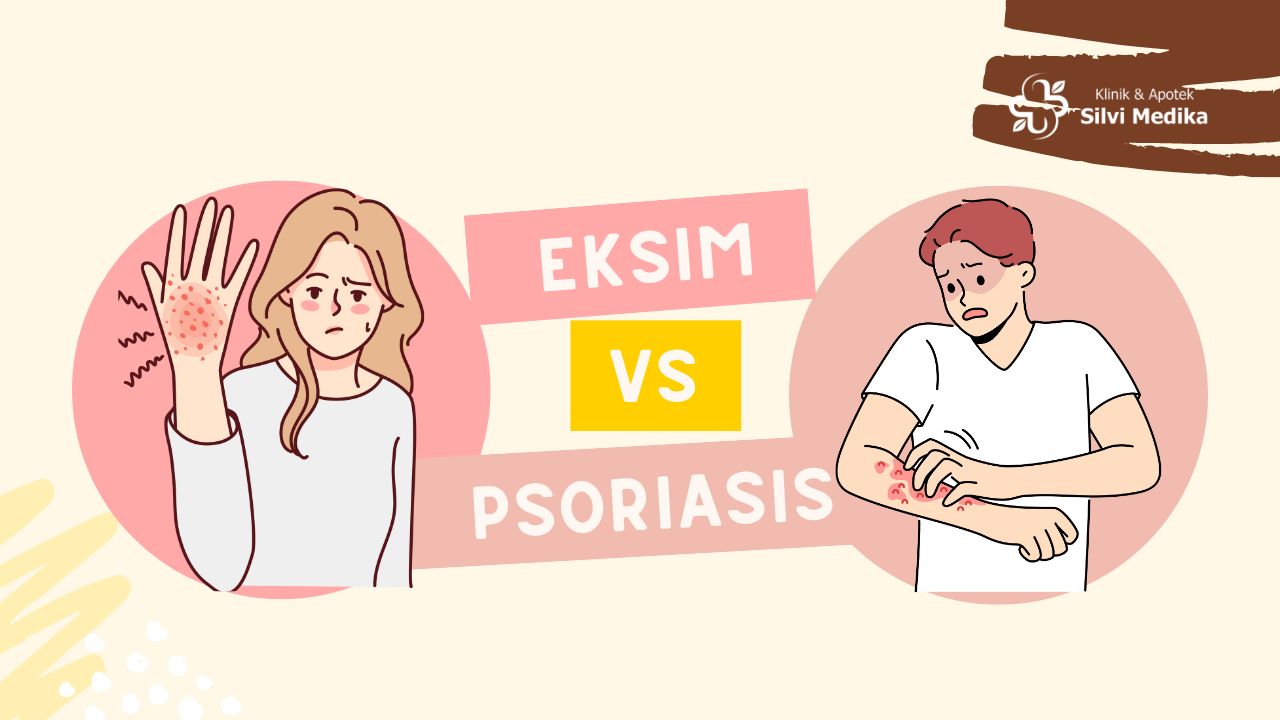 Eksim vs Psoriasis: 6 Perbedaan yang Perlu Diketahui